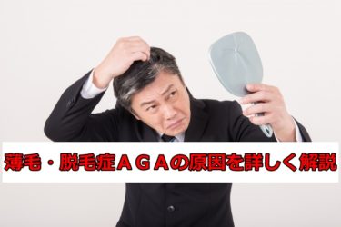 薄毛・脱毛症ＡＧＡの原因を詳しく解説